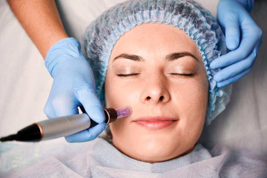 Dermapen